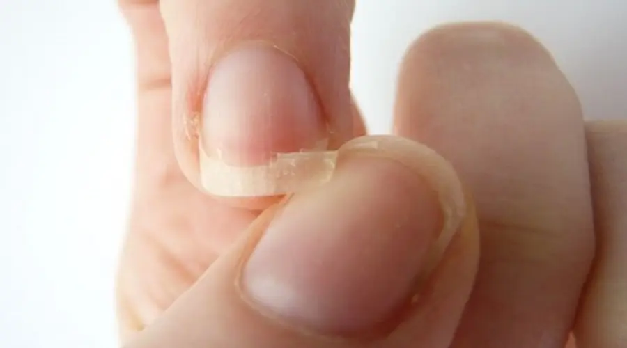 L'olio di argan: il rimedio per le unghie che si sfaldano