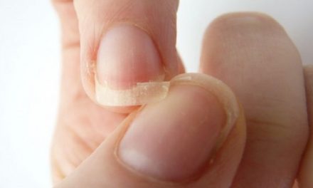 L’olio di argan: il rimedio per le unghie che si sfaldano